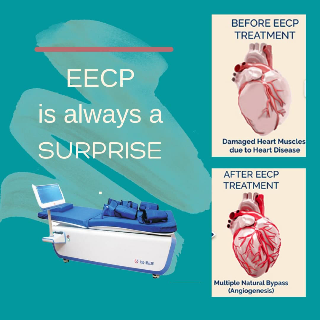 EECP